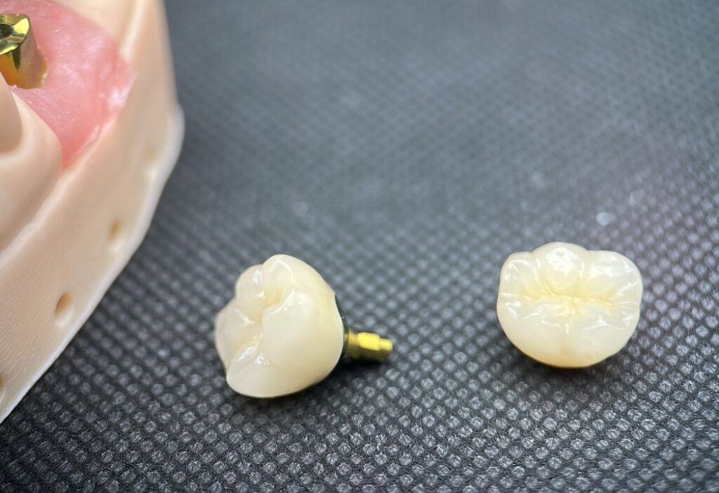 Custom Abutment