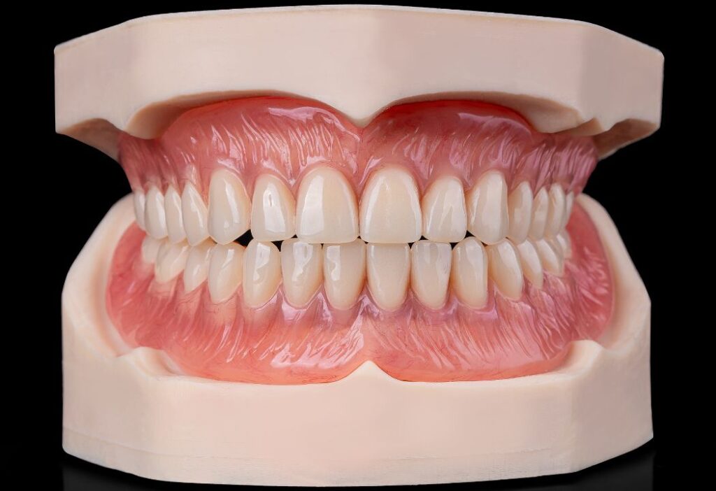 Full Acrylic Denture