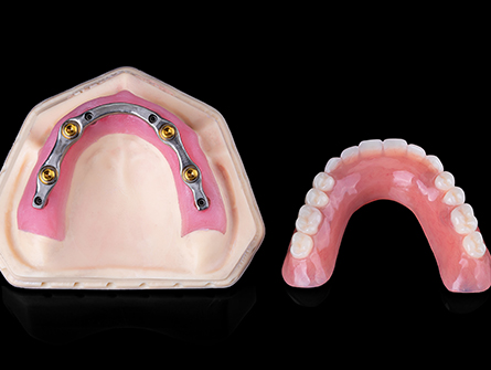 Titanium bar + Acrylic