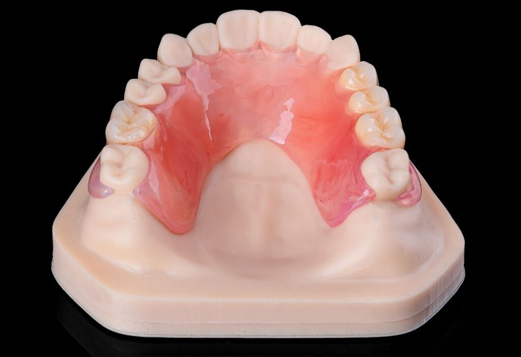 Partial acrylic denture