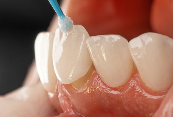 Diseños de laboratorio dental entre los que puede elegir