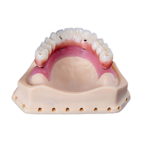 Caso del laboratorio dental Istar en China