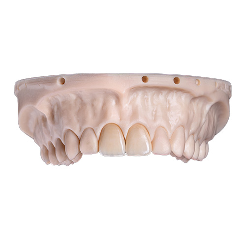 Caso del laboratorio dental Istar en China