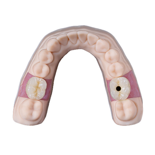 Caso del laboratorio dental Istar en China