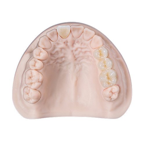 Caso del laboratorio dental Istar en China