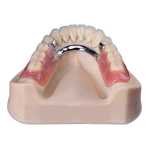 Caso del laboratorio dental Istar en China
