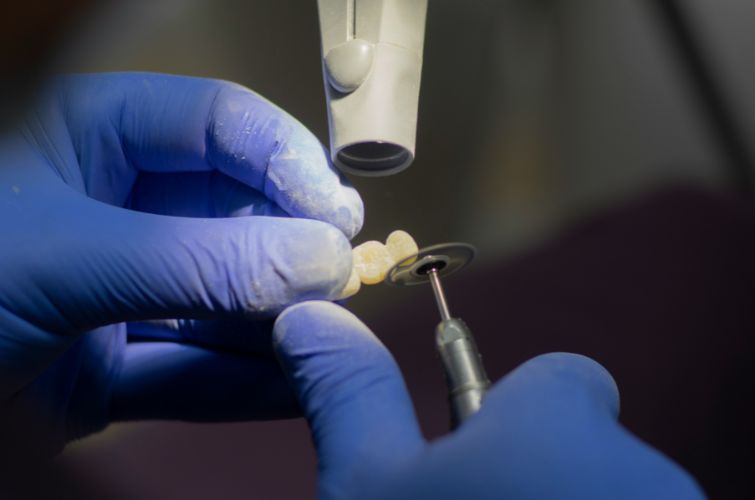 Preparacja zębów w laboratorium dentystycznym Istar