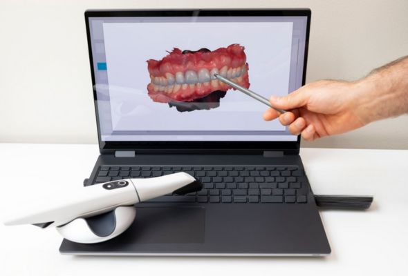 Soluzioni digitali 3D per il laboratorio odontotecnico