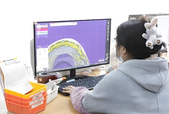 Fortschrittliche Technologie für PFM-Implantatkronen