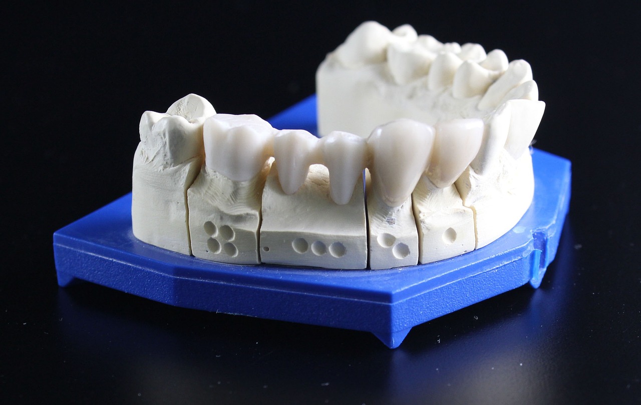 denti da laboratorio in zirconia