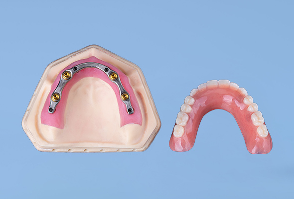 Implantater til tandproteser (2)