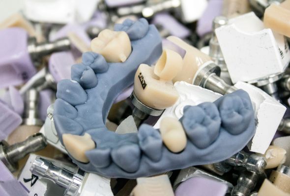 Digital Restorations Dental Lab