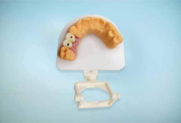 Laboratoire d'implants Istar Ideal Implants Fit
