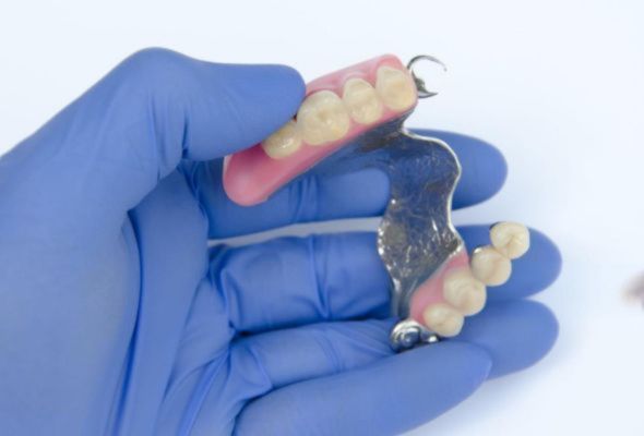 Protesi metallica Controllo di qualità rigoroso