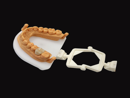 coronas dentales estéticas de óxido de circonio