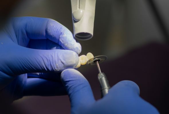 laboratorio dental en china garantía de calidad