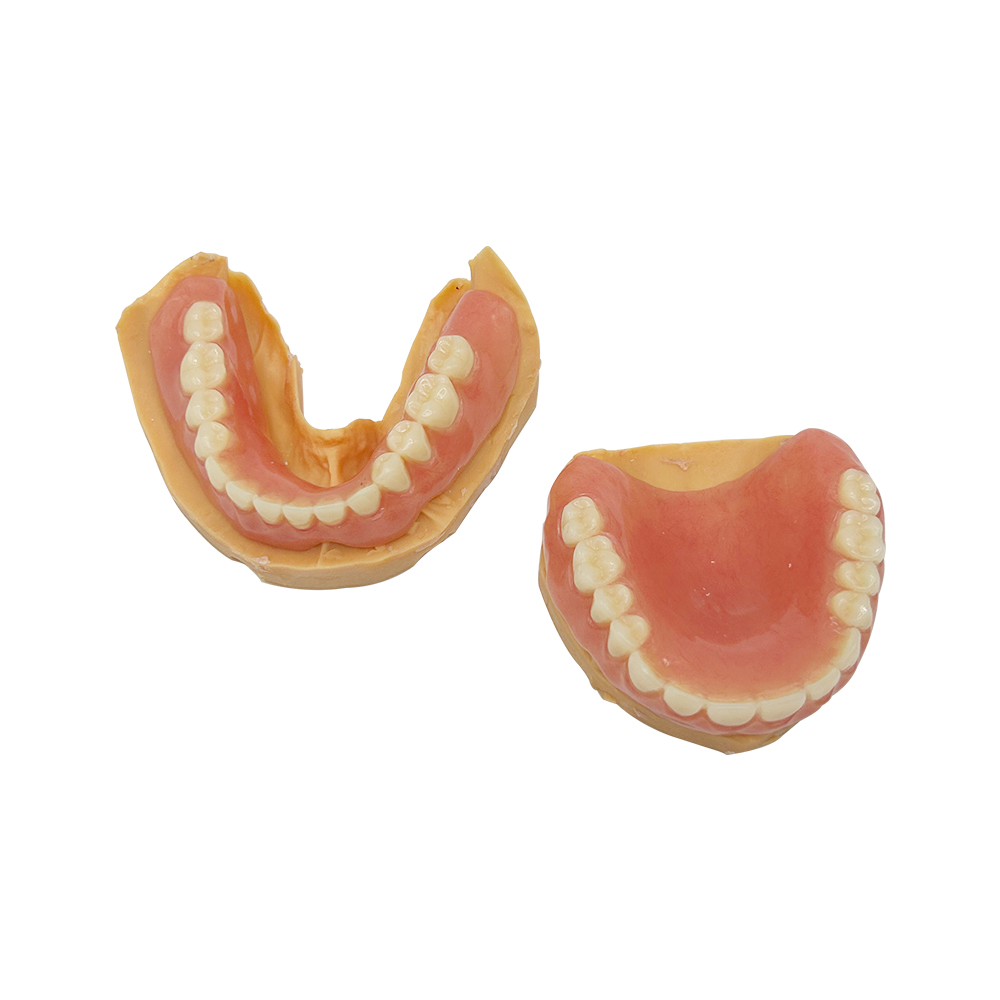 Teilprothese aus Acryl (2)