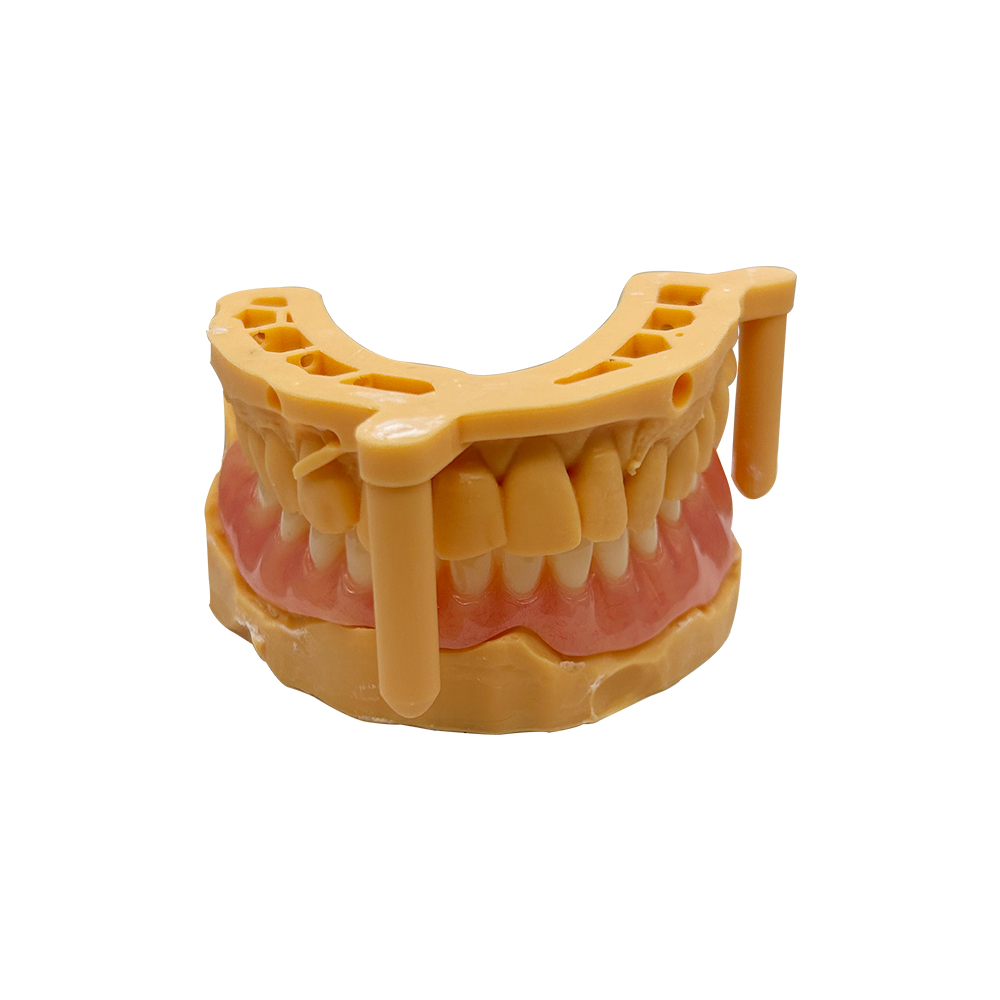 Teilprothese aus Acryl (3)