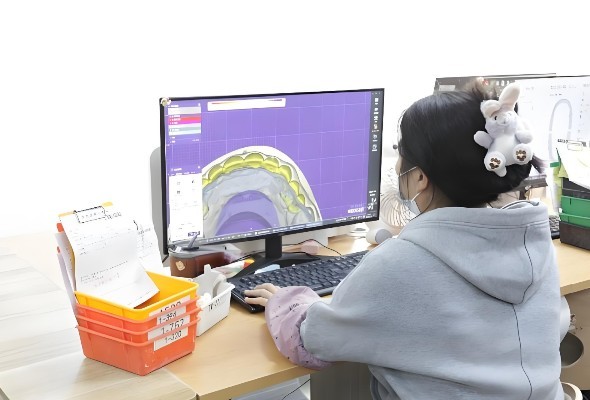 Processus de production avancé pour les facettes Emax