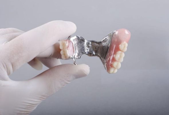 Protesi Co-Cr a prezzi accessibili