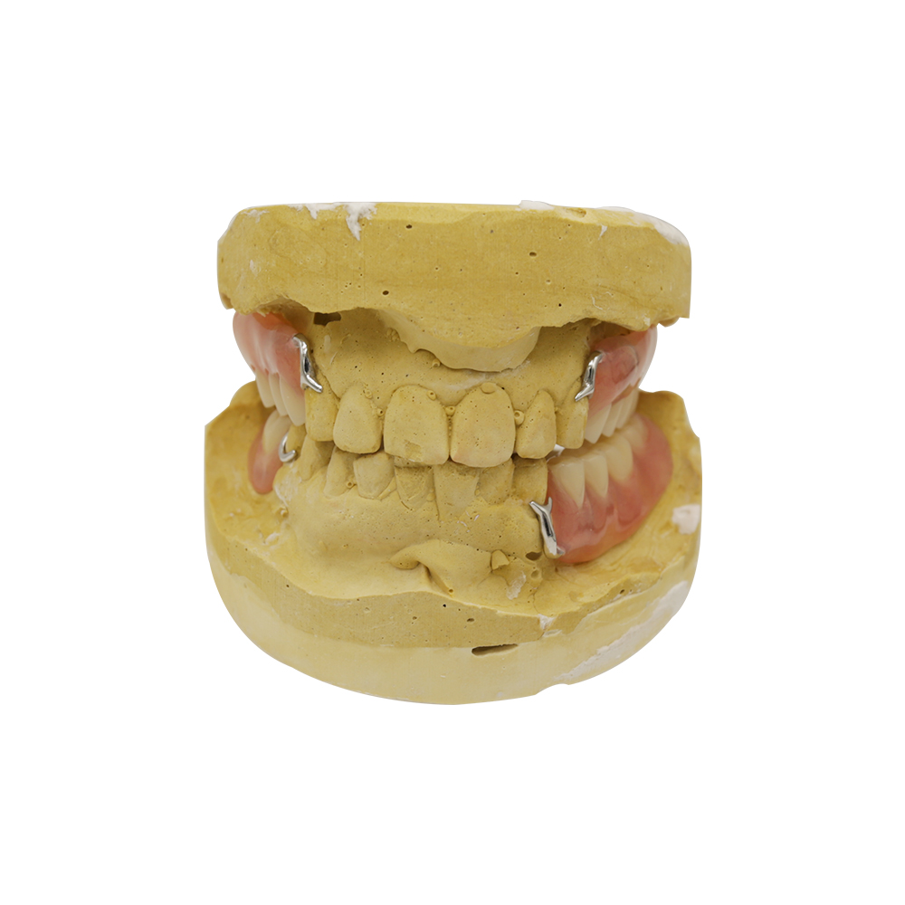Chrom-Kobalt-Denture-(3)
