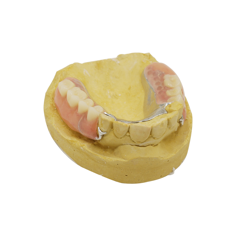 Dentures-With-Clasps-(1)