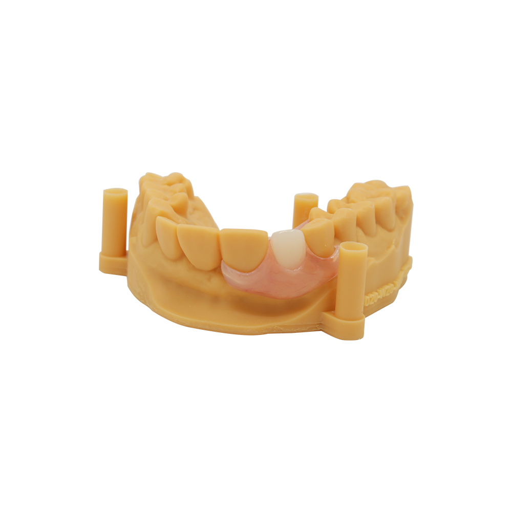 Flexi Denture Single Tooth de Istar - Certifié FDA