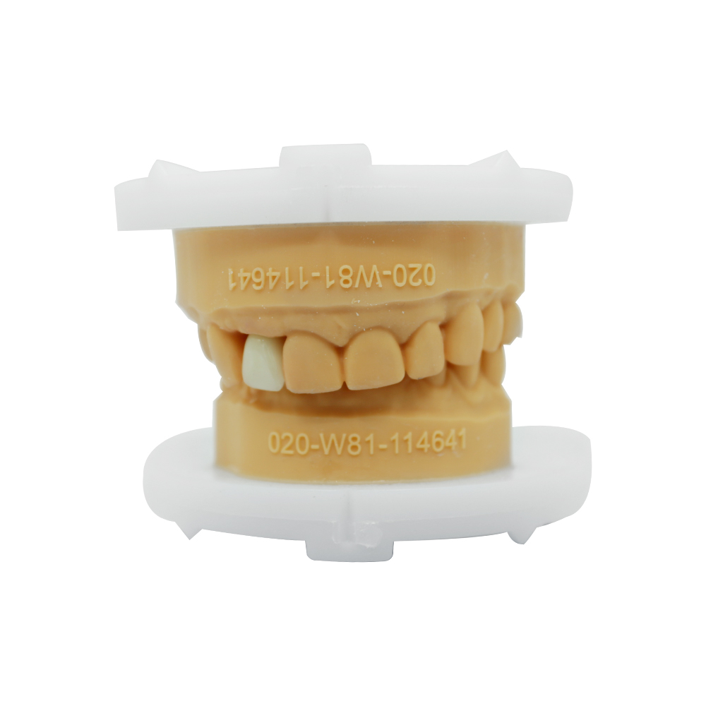 Geschichtete Zirkoniumdioxidkronen und -brücken (4)