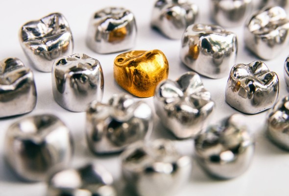 Opzioni di cappette metalliche per corone PFM anteriori