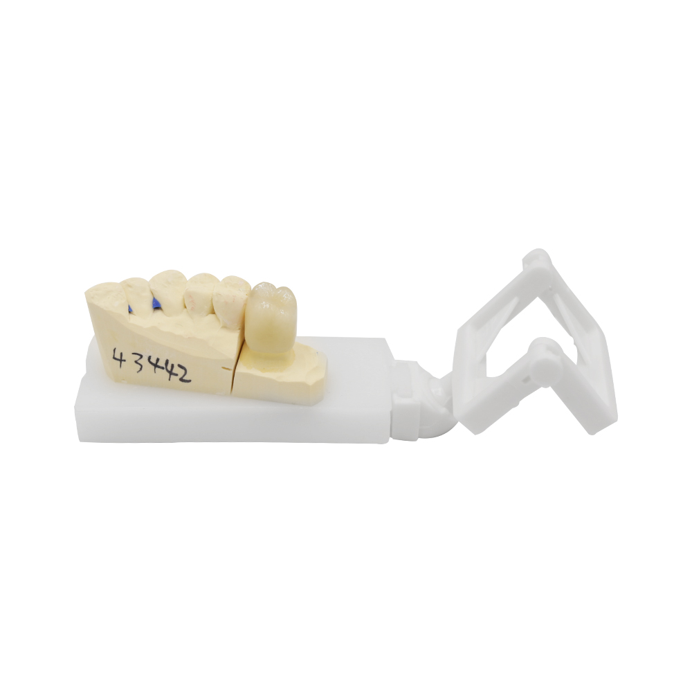 PFM Crown Molar & Premolar (2)