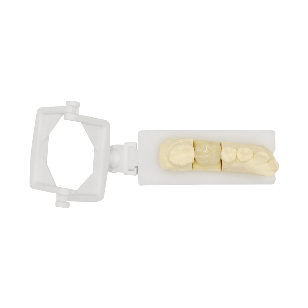 PFM Crown Molar & Premolar (3)