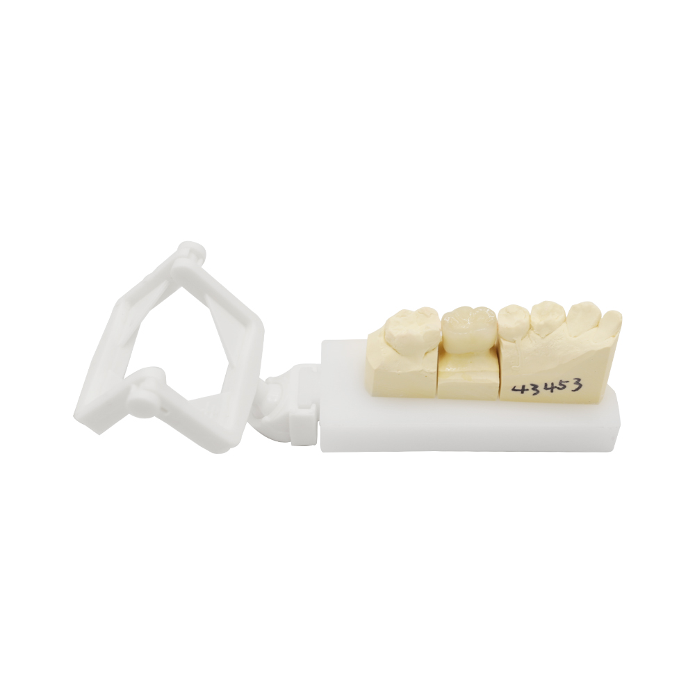 PFM Crown Molar & Premolar (4)