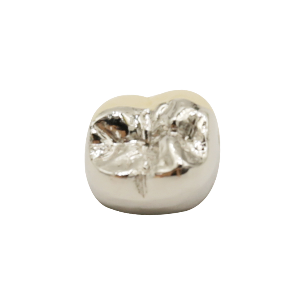 Коронка от PFM с метален лингвал (2)