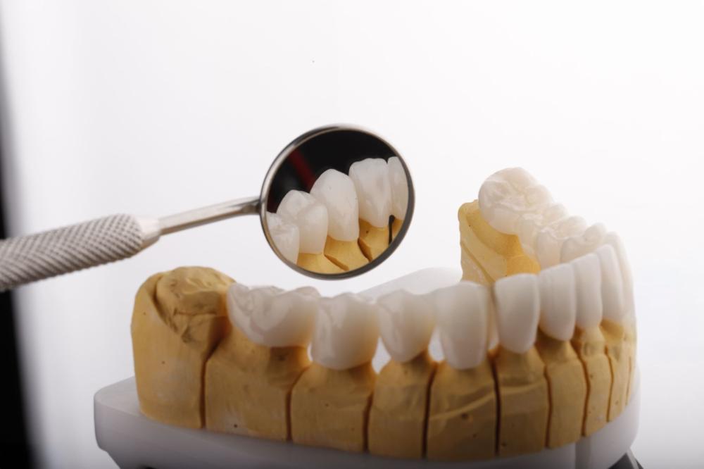 Stałe korony i mosty dentystyczne z tlenku cyrkonu