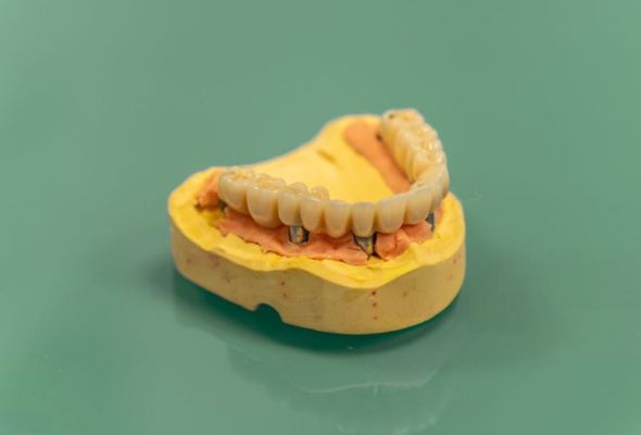 Processus strict de contrôle de la qualité All-on-X