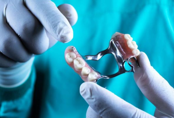 Material para prótesis dentales metálicas superiores by Istar