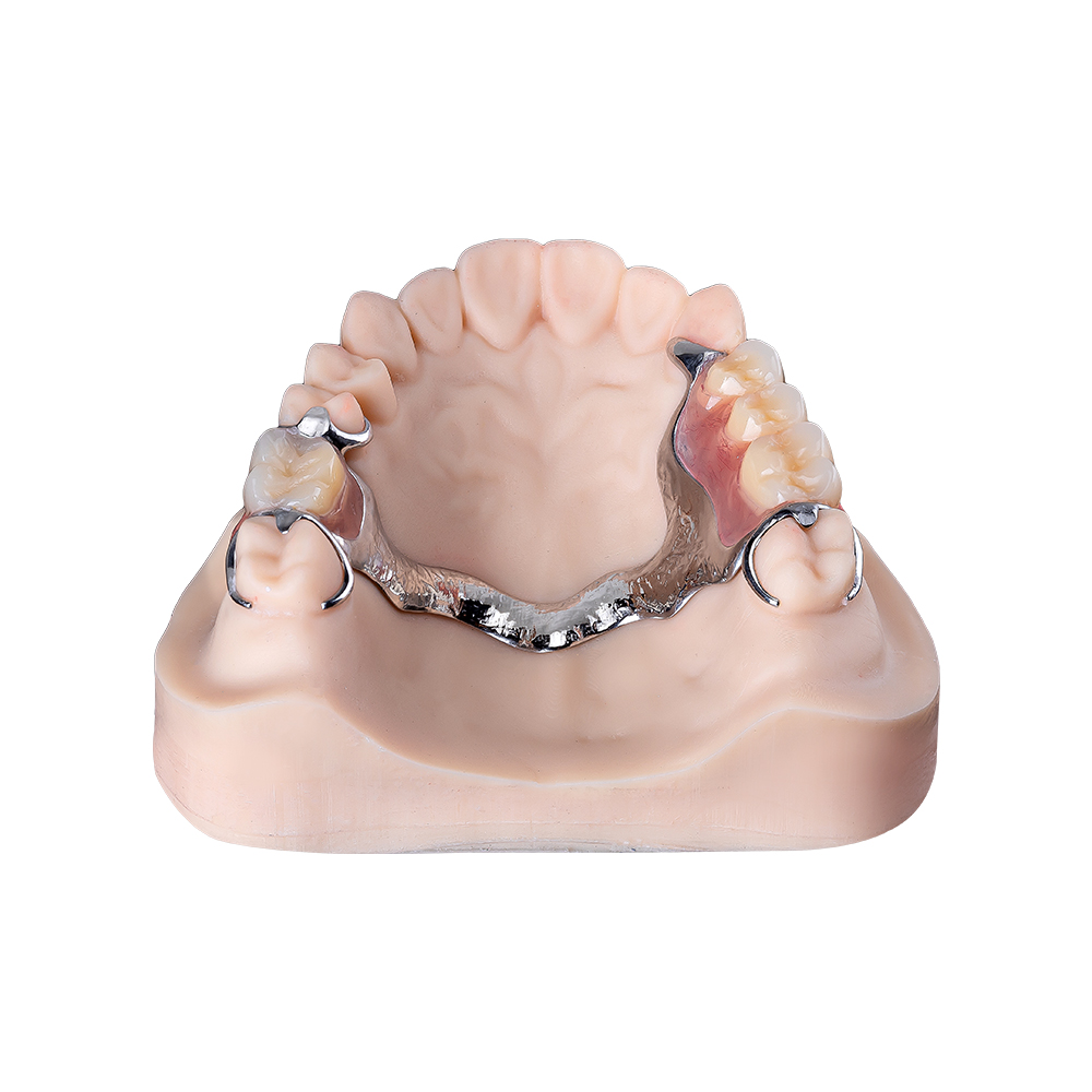 Prothèses dentaires Vitallium (1)