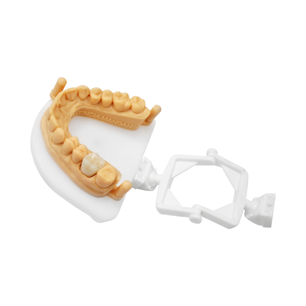 Zirkoniumdioxid-Krone für Seitenzähne (2)