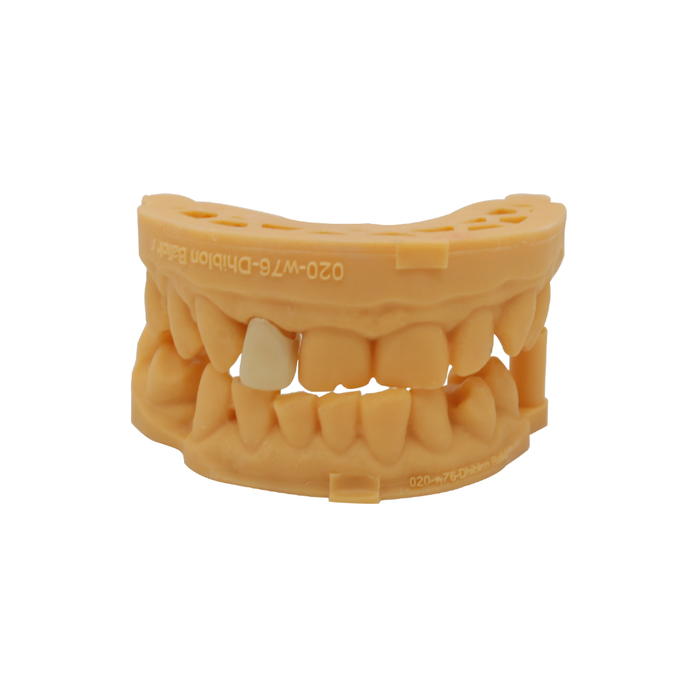 Corone dentali E.max-1