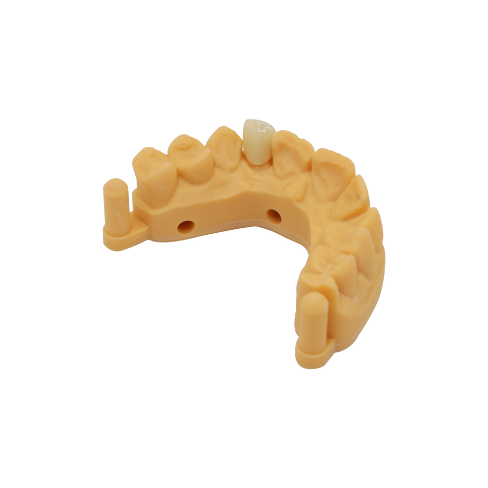 E.max Corone dentali