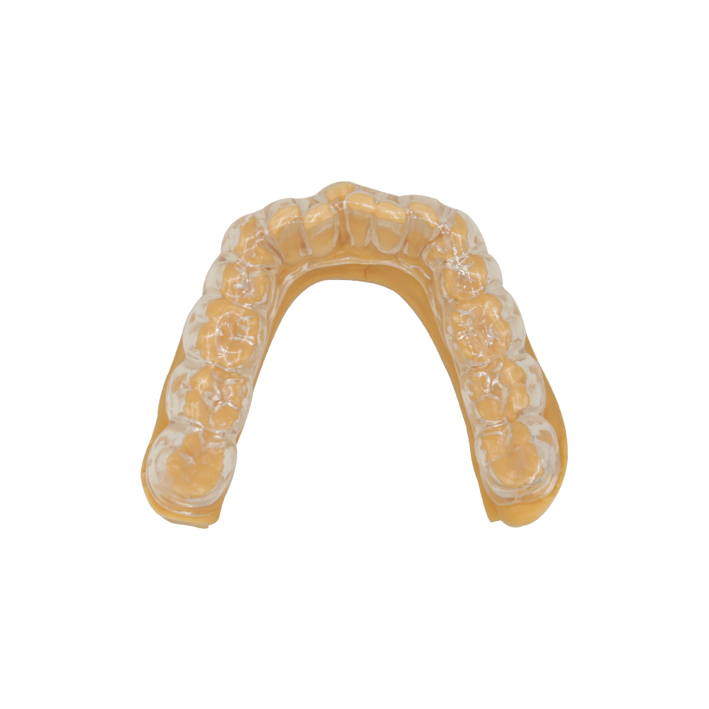 Essix - Retainer ortodontici (1)