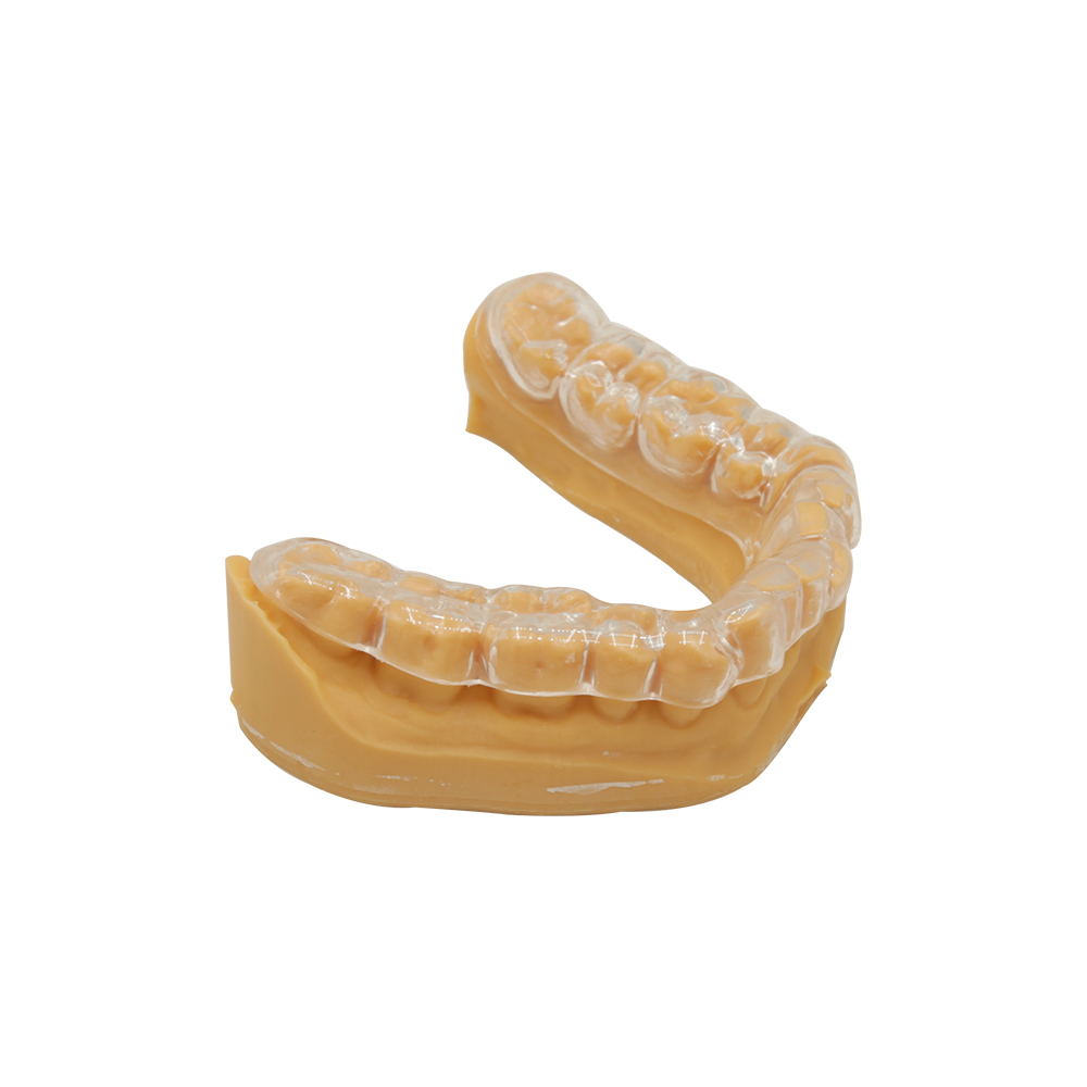 Essix - Retainer ortodontici (4)