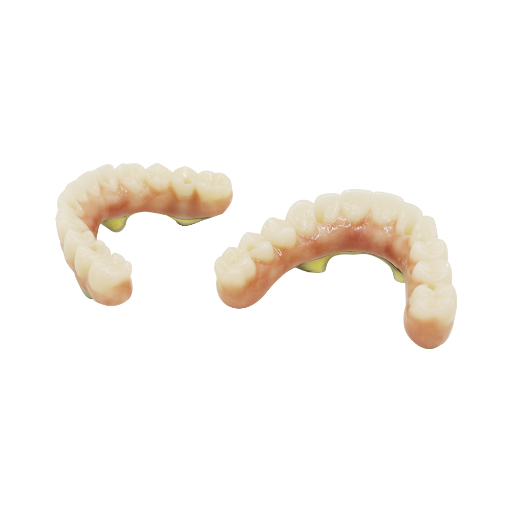 Implantes dentales de arcada completa (1)