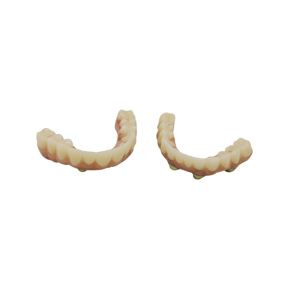 Implantes dentales de arcada completa (3)