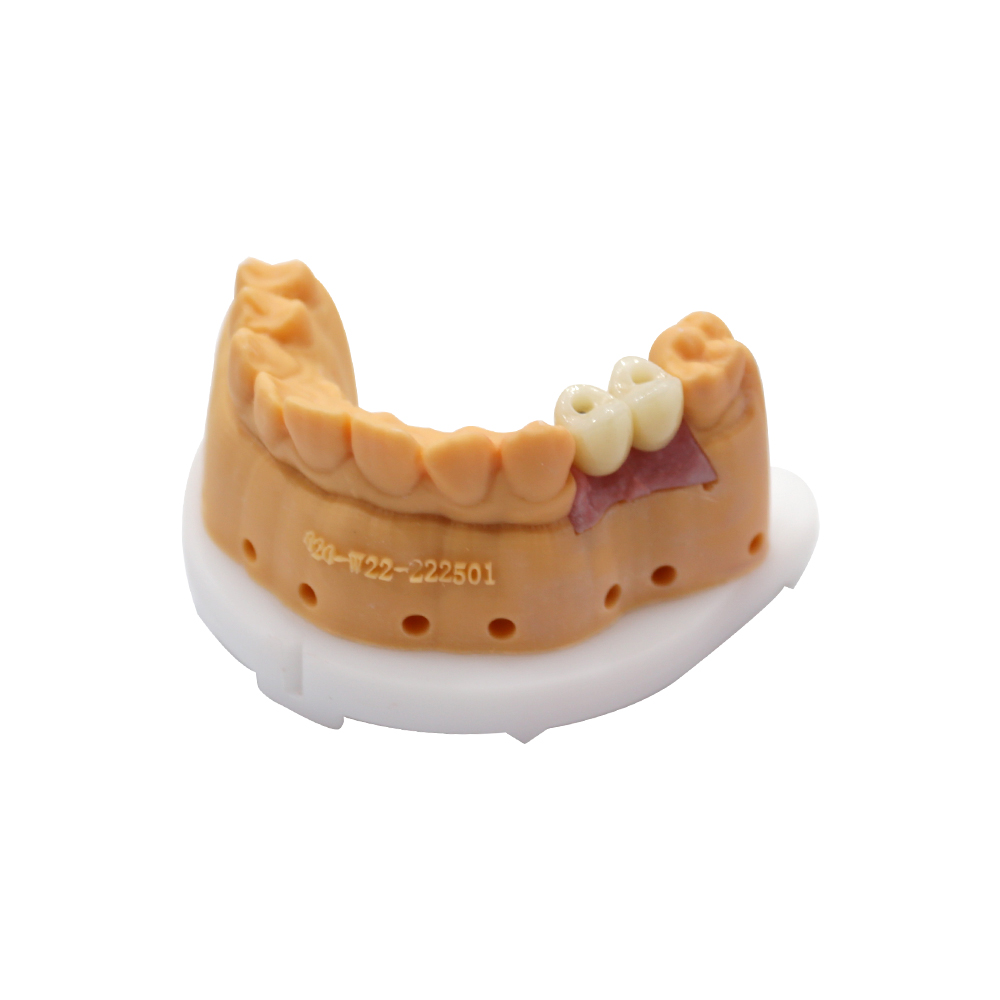 Mini implanty dentystyczne-3