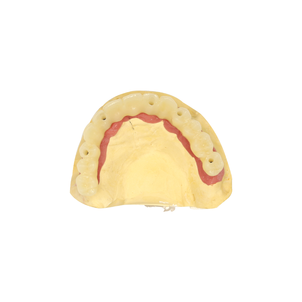 Mini implanty dentystyczne