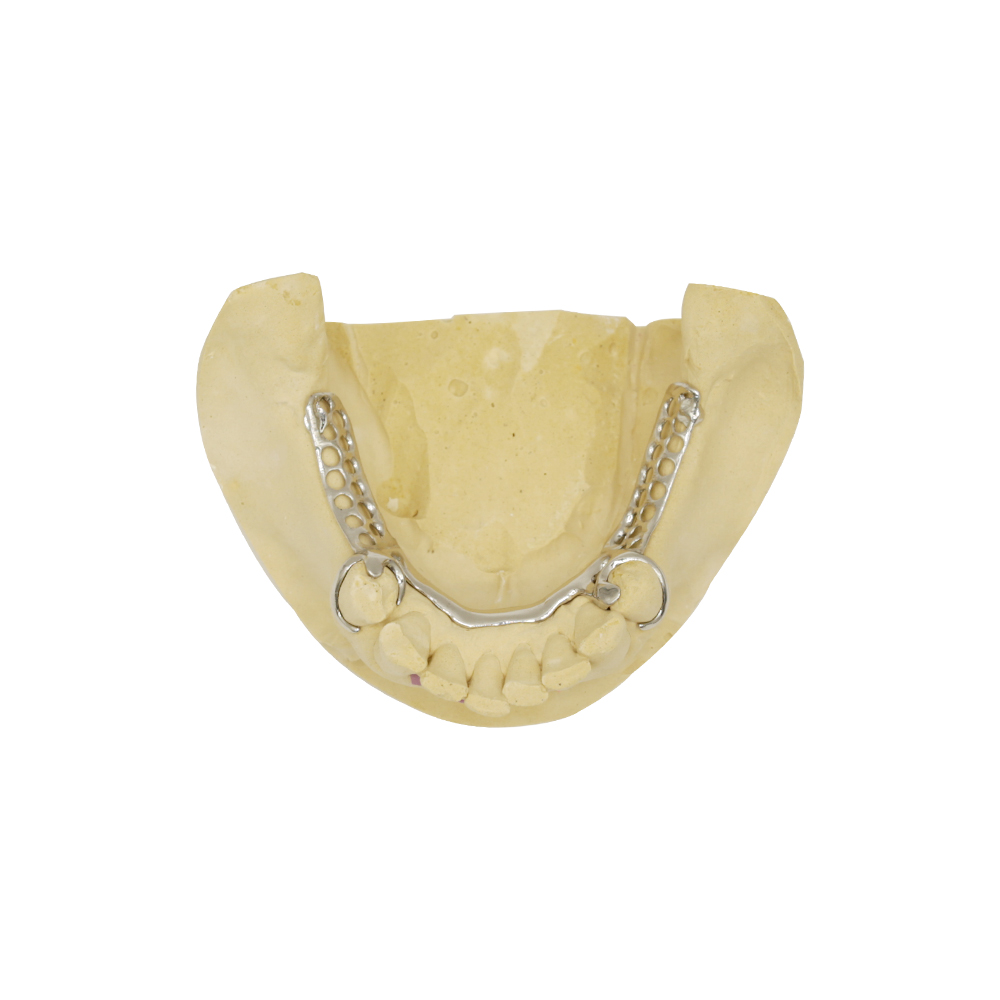 티타늄 틀니 (1)