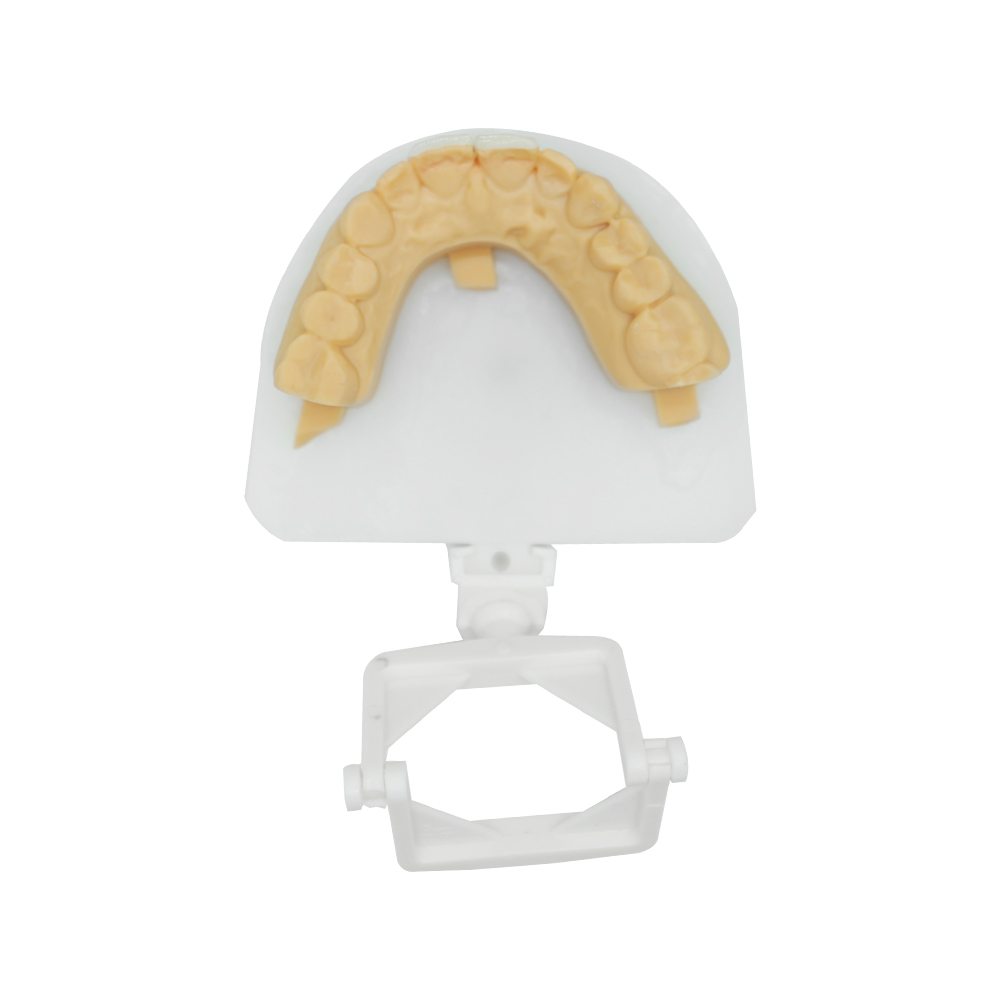 지르코니아 베니어 (1)