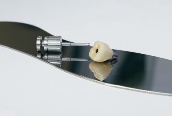 Corona implantare avvitata in zirconiaPFM di Istar
