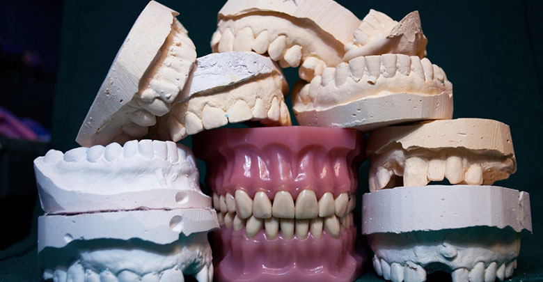 Cost of Dental Restoration